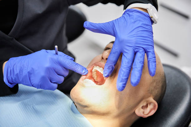 Best Emergency Wisdom Teeth Removal in Allendale, SC